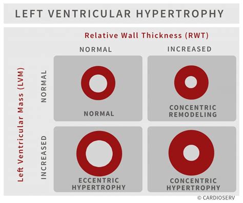 lvh echo criteria wall thickness